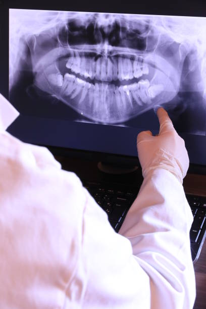 Best Same-Day Emergency Dentist in Pacific Grove, CA